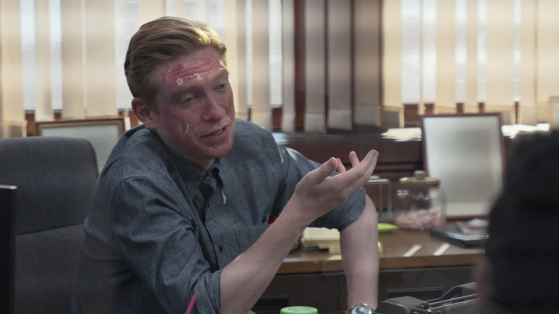 I had a bit of a reaction to the chemical peel.